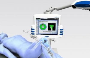 Computer Assisted Total Knee Replacement Surgery computer-assisted-knee