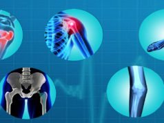 Bone and Joint bone-and-joint