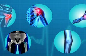 Bone and Joint bone-and-joint