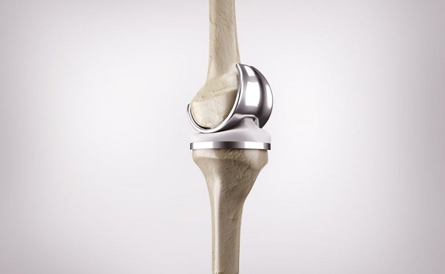 knee-replacement-joint1.jpg