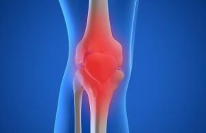 Osteoarthritis osteoarthritis.jpg