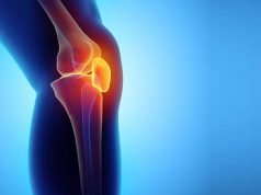 What to know about Knee Replacement Surgery knee