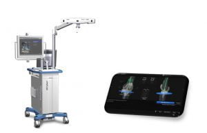 Navigation Robotic Surgery India