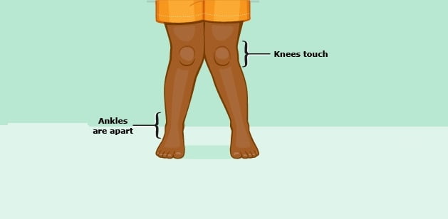 A Surgical Procedure That Ensures Minimal Hospital Stay
