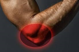 tennis elbow surgery
