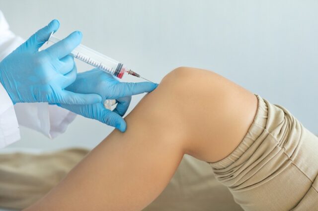 PRP for the Management of Osteoarthritis of the Hip and Knee and Tendinitis
