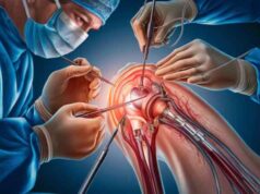 Best knee Replacement hospital in India-Ashish Joint replacement center(AJRC) Patna Best Knee Replacement Surgeon in India